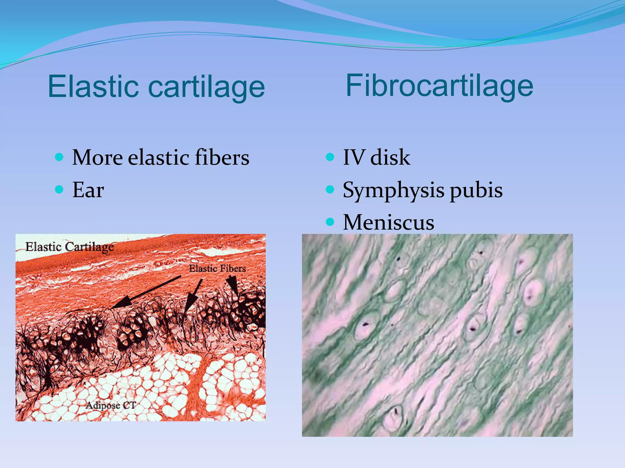 Elastic cartilage         Fibrocartilage

 More elastic fibers    IV disk
 Ear                    Symphysis pubis
                         Meniscus
 