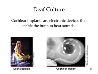 Deaf Culture Cochlear implants are electronic devices that enable the brain to hear sounds.  Cochlear Implant Deaf Musician EG Images/ J.S. Wilson © Wolfgang Gstottner. (2004)  American  Scientist,  Vol. 92, Number 5. (p. 437) 