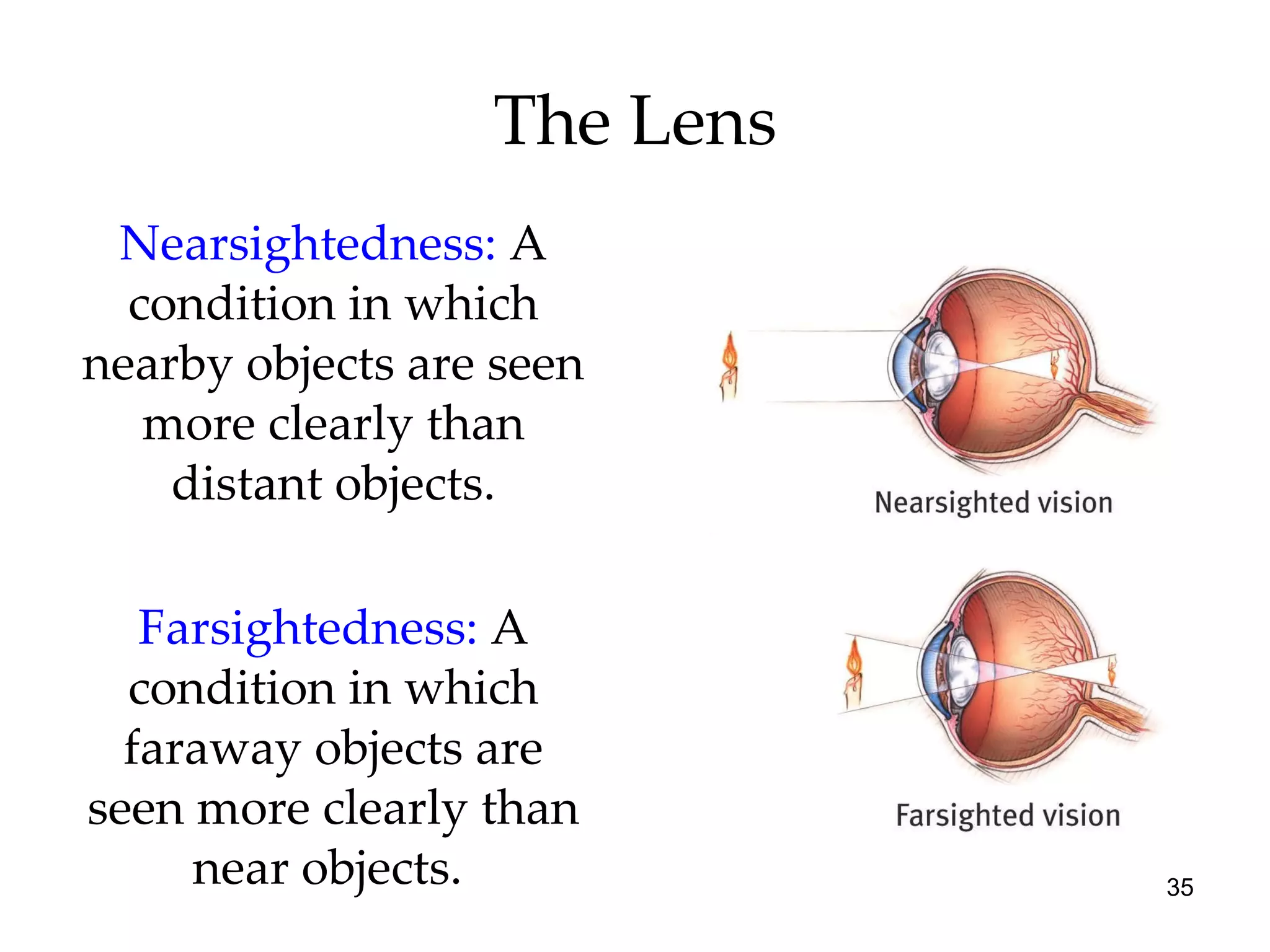 The Lens Nearsightedness:  A condition in which nearby objects are seen more clearly than distant objects. Farsightedness:   A condition in which faraway objects are seen more clearly than near objects.  