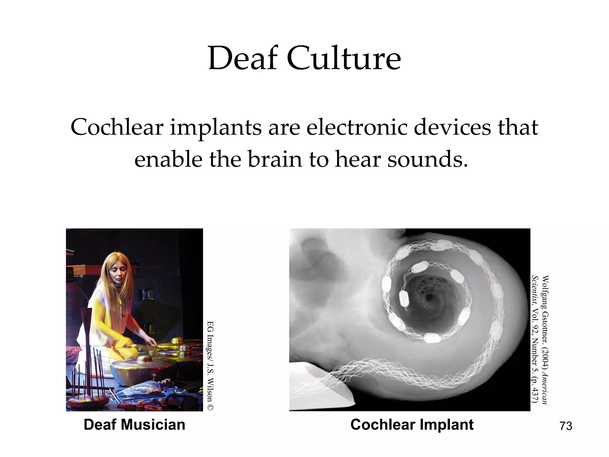 Deaf Culture Cochlear implants are electronic devices that enable the brain to hear sounds.  Cochlear Implant Deaf Musician EG Images/ J.S. Wilson © Wolfgang Gstottner. (2004)  American  Scientist,  Vol. 92, Number 5. (p. 437) 