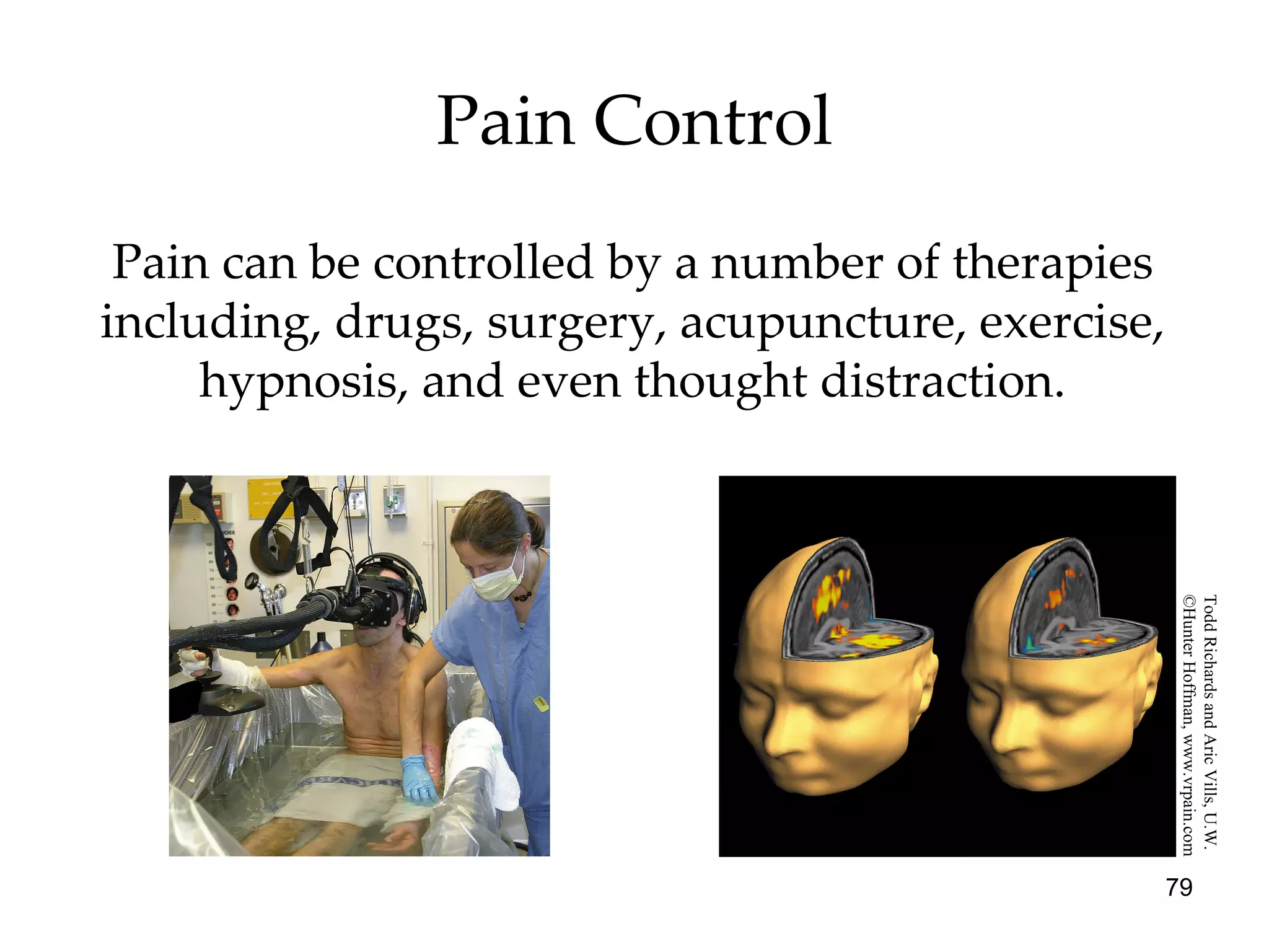 Pain Control Pain can be controlled by a number of therapies including, drugs, surgery, acupuncture, exercise, hypnosis, and even thought distraction. Todd Richards and Aric Vills, U.W.  ©Hunter Hoffman, www.vrpain.com 