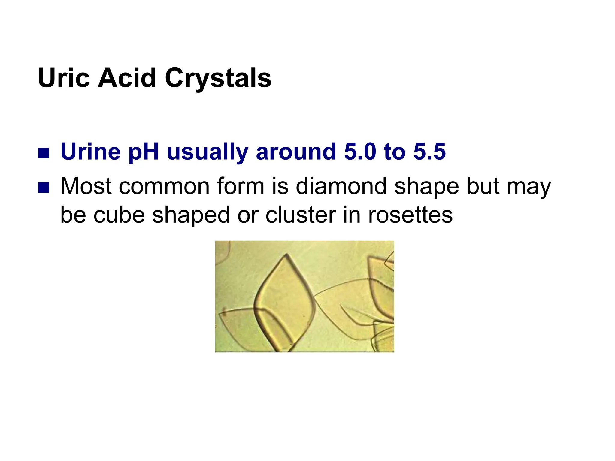 Uric Acid Crystals
 Urine pH usually around 5.0 to 5.5
 Most common form is diamond shape but may
be cube shaped or cluster in rosettes
 