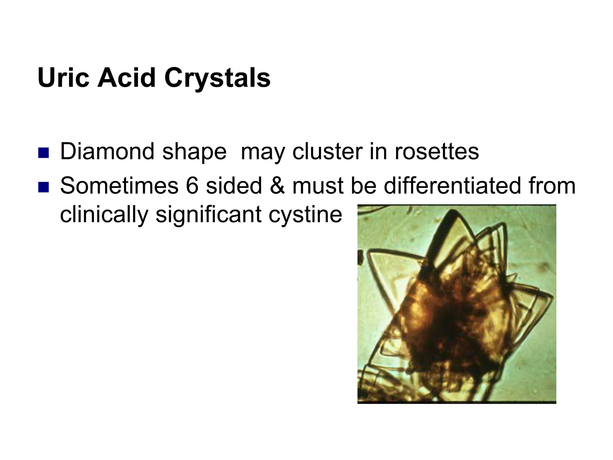 Uric Acid Crystals
 Diamond shape may cluster in rosettes
 Sometimes 6 sided & must be differentiated from
clinically significant cystine
 