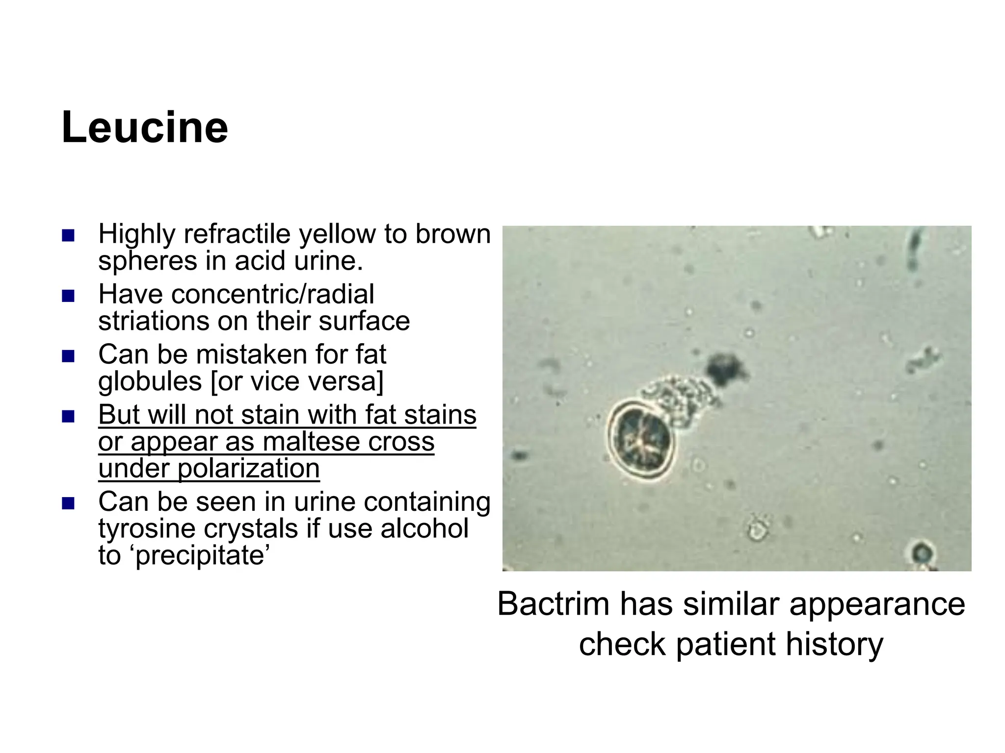 Leucine
 Highly refractile yellow to brown
spheres in acid urine.
 Have concentric/radial
striations on their surface
 Can be mistaken for fat
globules [or vice versa]
 But will not stain with fat stains
or appear as maltese cross
under polarization
 Can be seen in urine containing
tyrosine crystals if use alcohol
to ‘precipitate’
Bactrim has similar appearance
check patient history
 