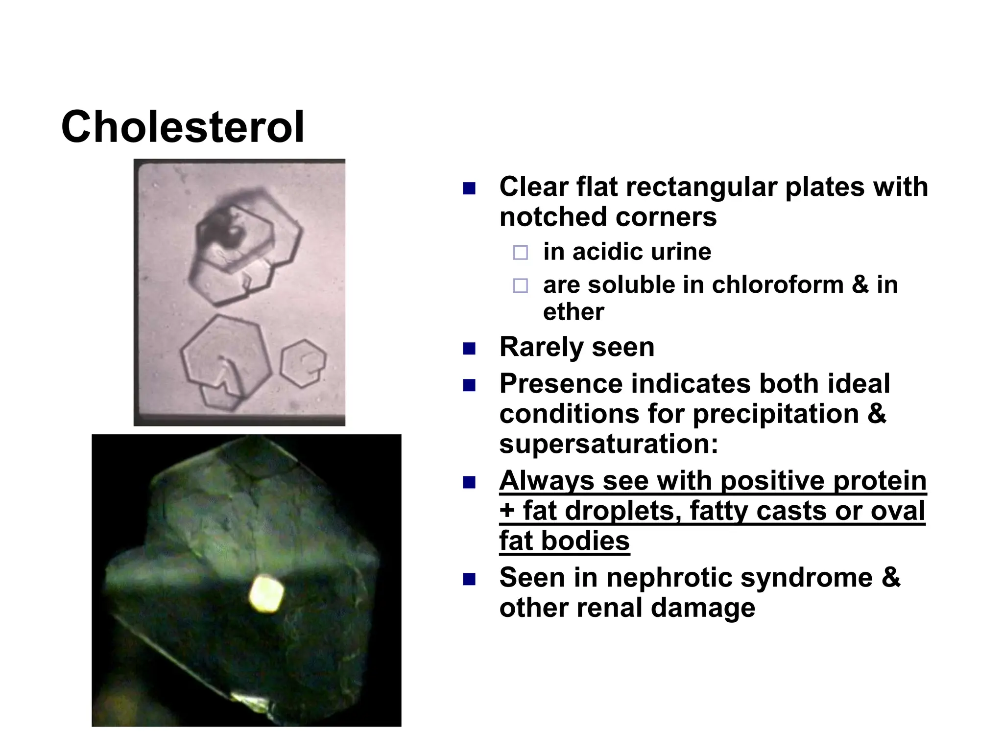 Cholesterol
 Clear flat rectangular plates with
notched corners
 in acidic urine
 are soluble in chloroform & in
ether
 Rarely seen
 Presence indicates both ideal
conditions for precipitation &
supersaturation:
 Always see with positive protein
+ fat droplets, fatty casts or oval
fat bodies
 Seen in nephrotic syndrome &
other renal damage
 
