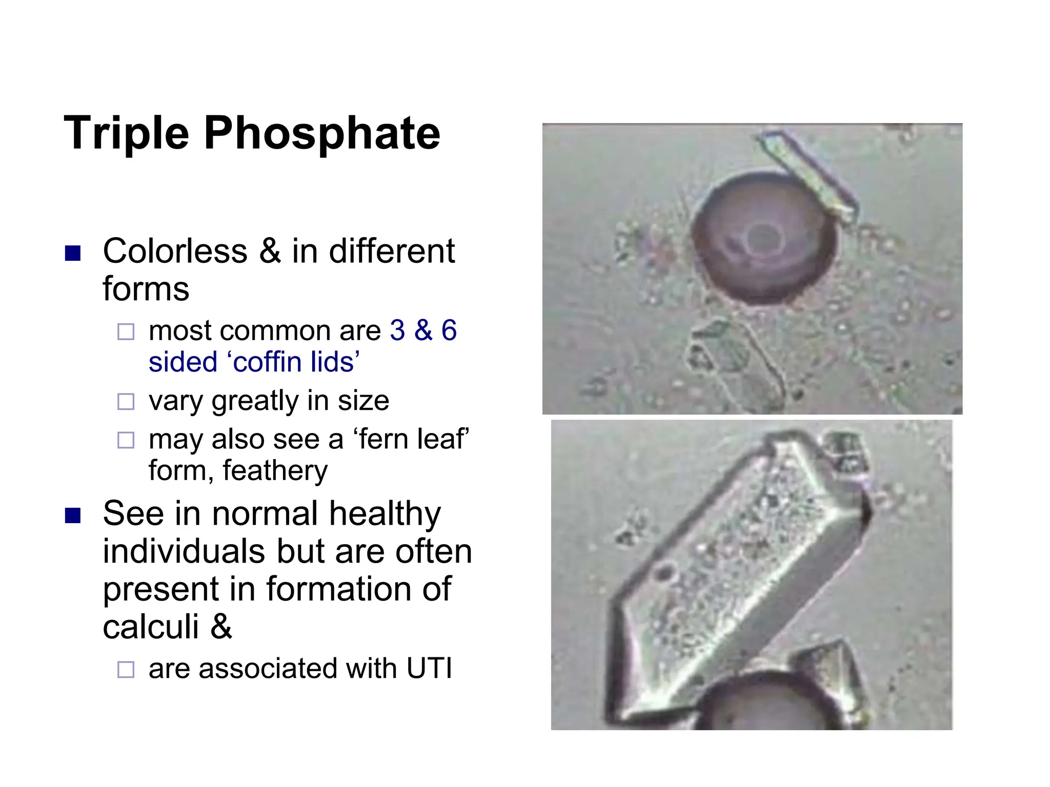 Triple Phosphate
 Colorless & in different
forms
 most common are 3 & 6
sided ‘coffin lids’
 vary greatly in size
 may also see a ‘fern leaf’
form, feathery
 See in normal healthy
individuals but are often
present in formation of
calculi &
 are associated with UTI
 