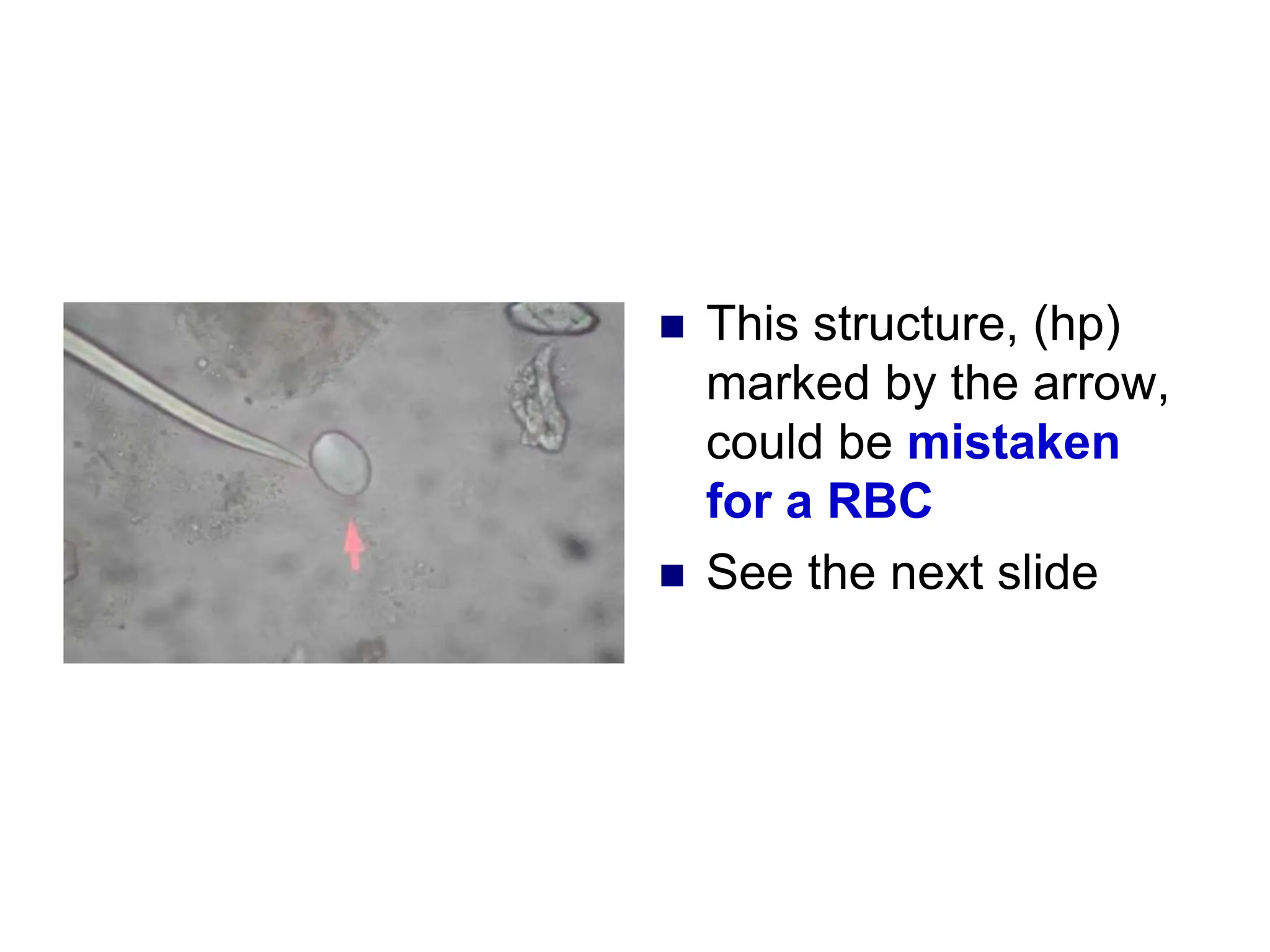  This structure, (hp)
marked by the arrow,
could be mistaken
for a RBC
 See the next slide
 