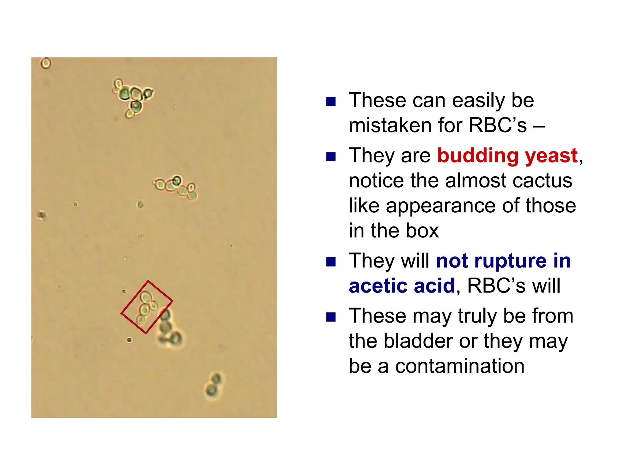  These can easily be
mistaken for RBC’s –
 They are budding yeast,
notice the almost cactus
like appearance of those
in the box
 They will not rupture in
acetic acid, RBC’s will
 These may truly be from
the bladder or they may
be a contamination
 