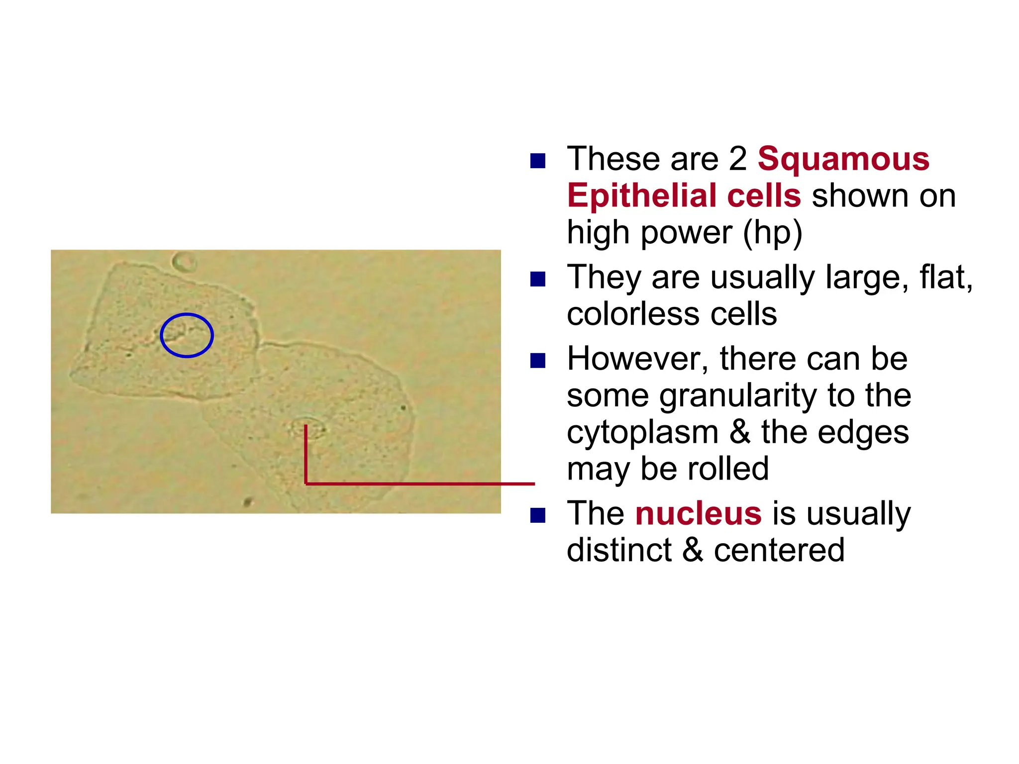  These are 2 Squamous
Epithelial cells shown on
high power (hp)
 They are usually large, flat,
colorless cells
 However, there can be
some granularity to the
cytoplasm & the edges
may be rolled
 The nucleus is usually
distinct & centered
 