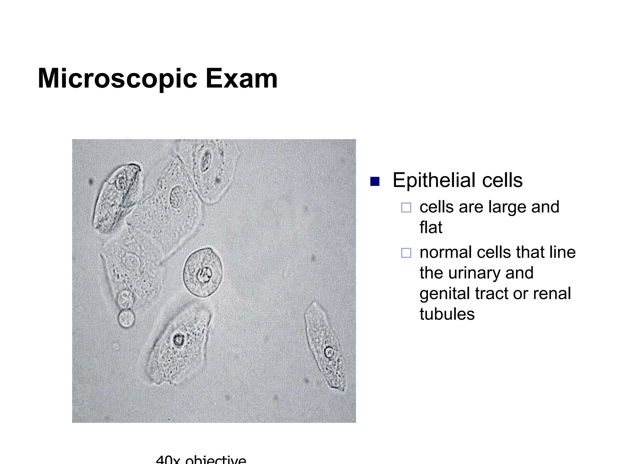 Microscopic Exam
 Epithelial cells
 cells are large and
flat
 normal cells that line
the urinary and
genital tract or renal
tubules
 