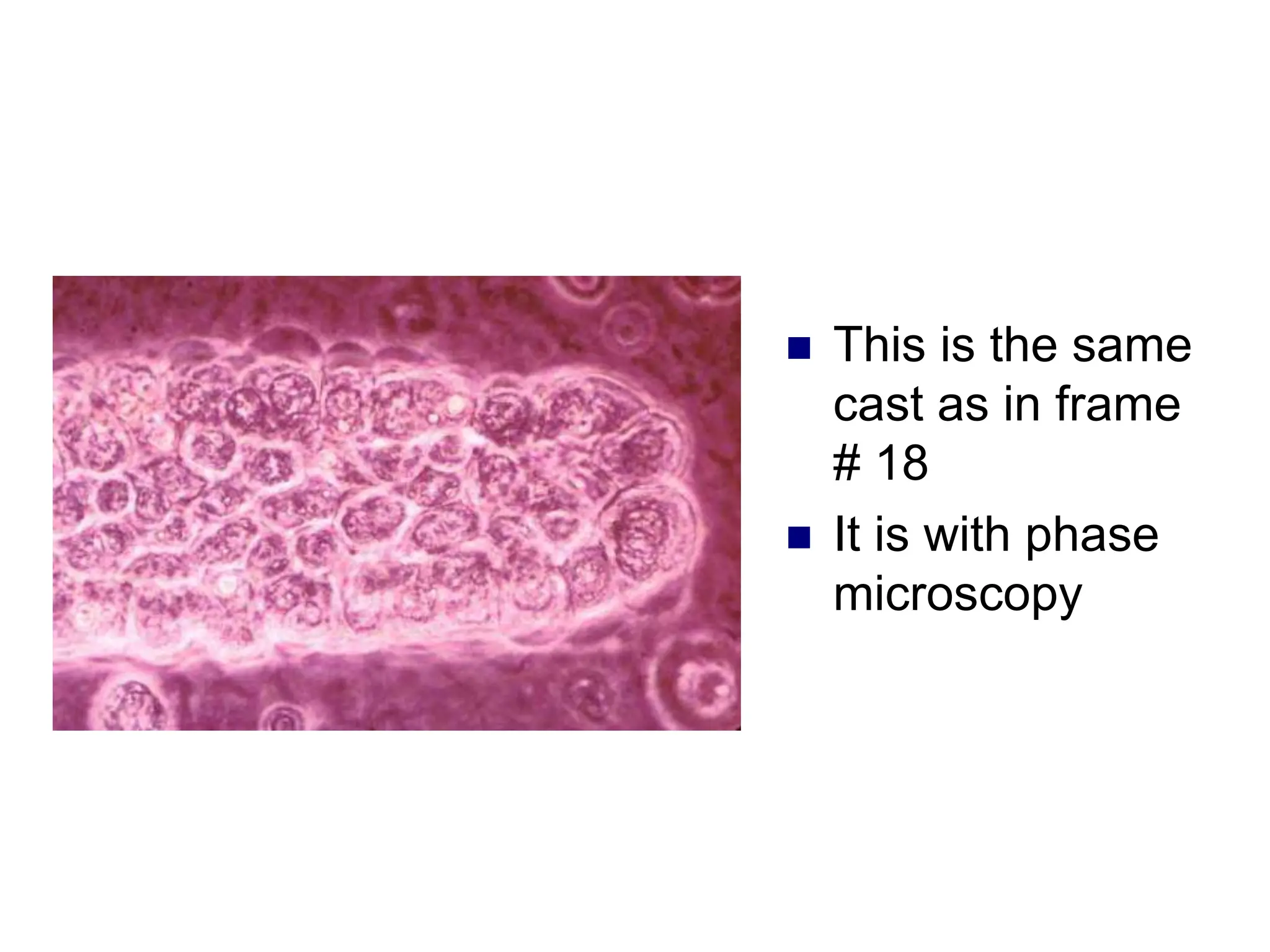  This is the same
cast as in frame
# 18
 It is with phase
microscopy
 