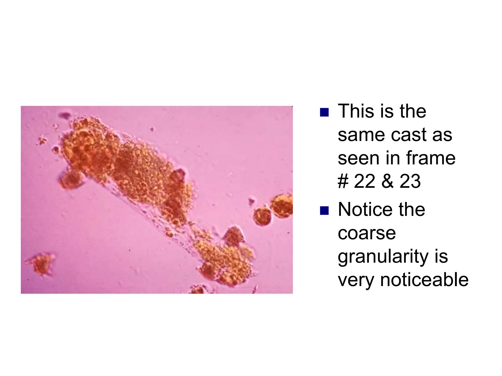  This is the
same cast as
seen in frame
# 22 & 23
 Notice the
coarse
granularity is
very noticeable
 