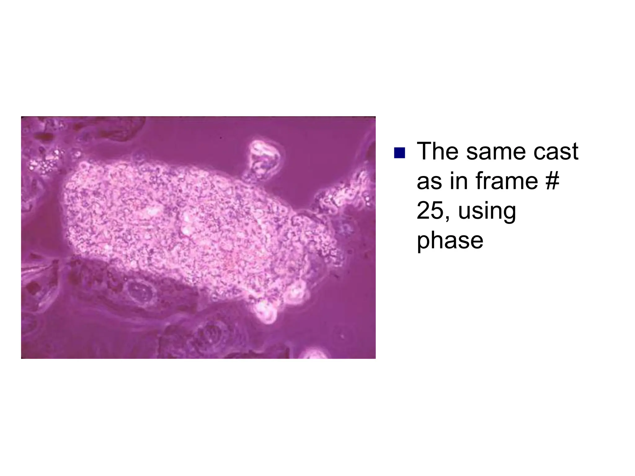  The same cast
as in frame #
25, using
phase
 
