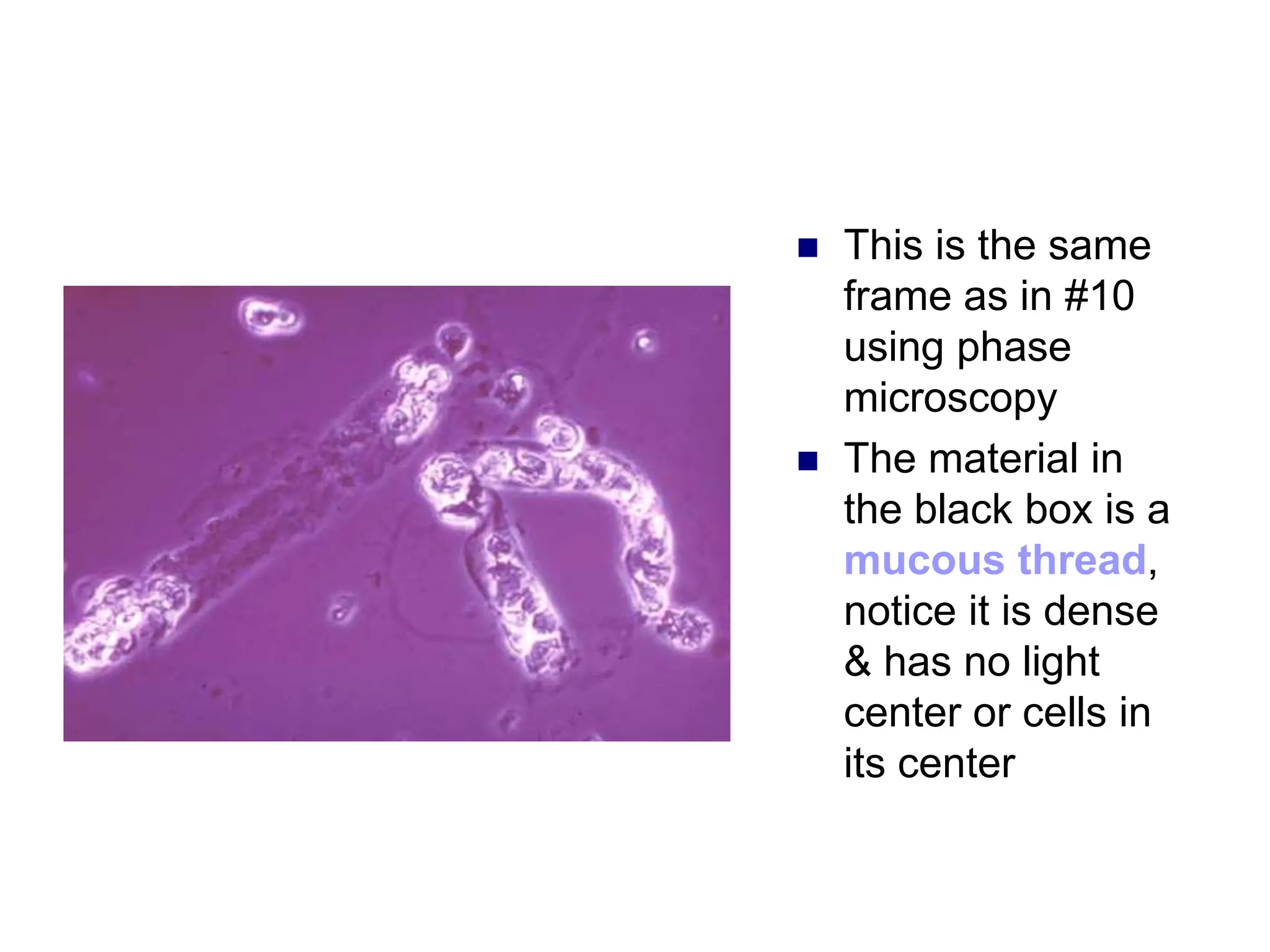  This is the same
frame as in #10
using phase
microscopy
 The material in
the black box is a
mucous thread,
notice it is dense
& has no light
center or cells in
its center
 