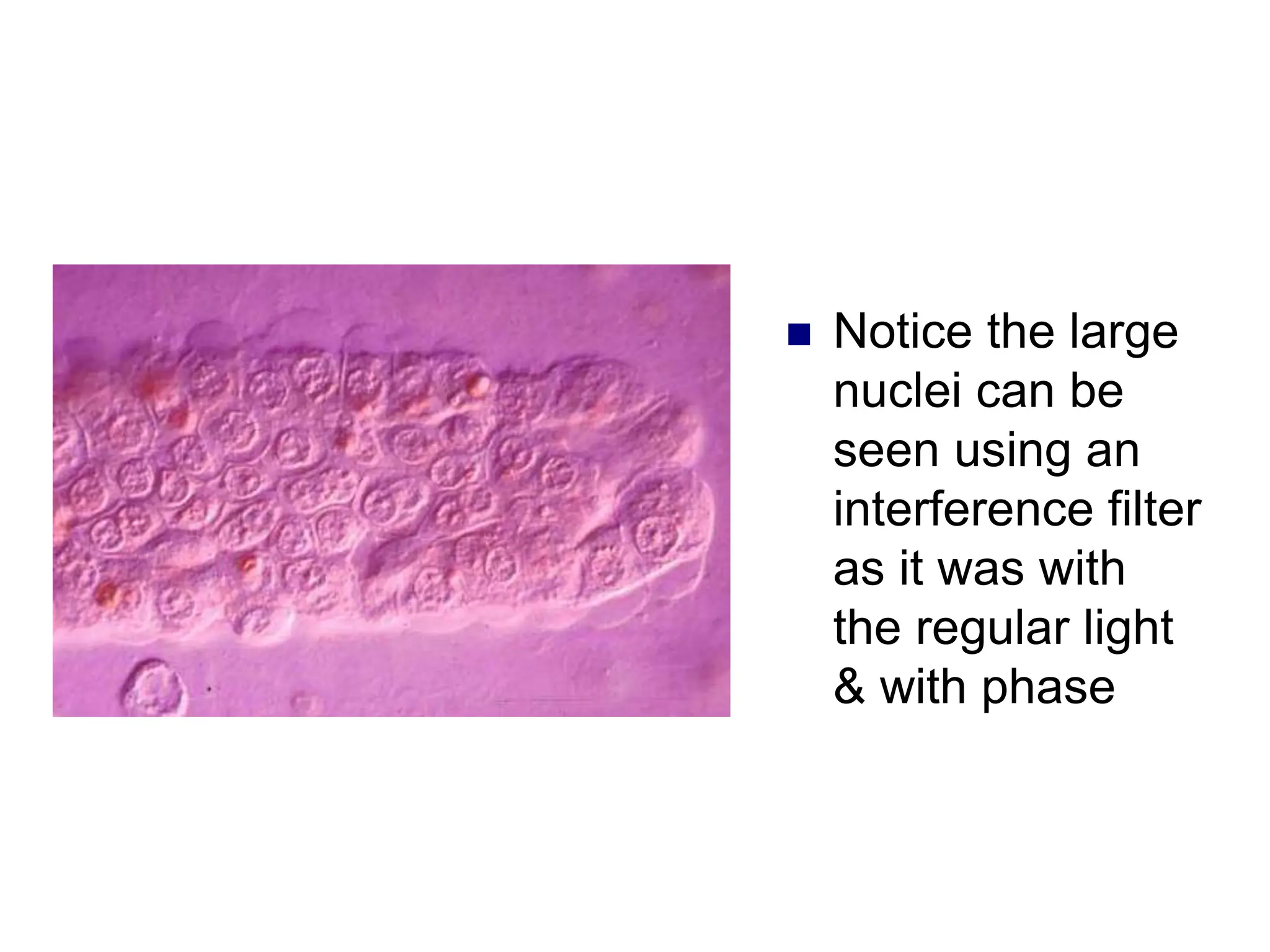  Notice the large
nuclei can be
seen using an
interference filter
as it was with
the regular light
& with phase
 