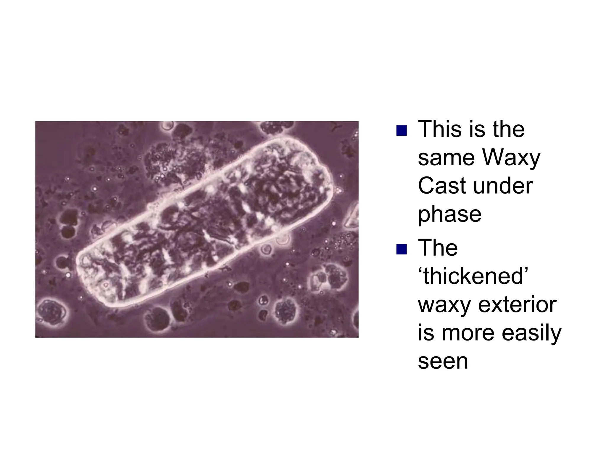  This is the
same Waxy
Cast under
phase
 The
‘thickened’
waxy exterior
is more easily
seen
 