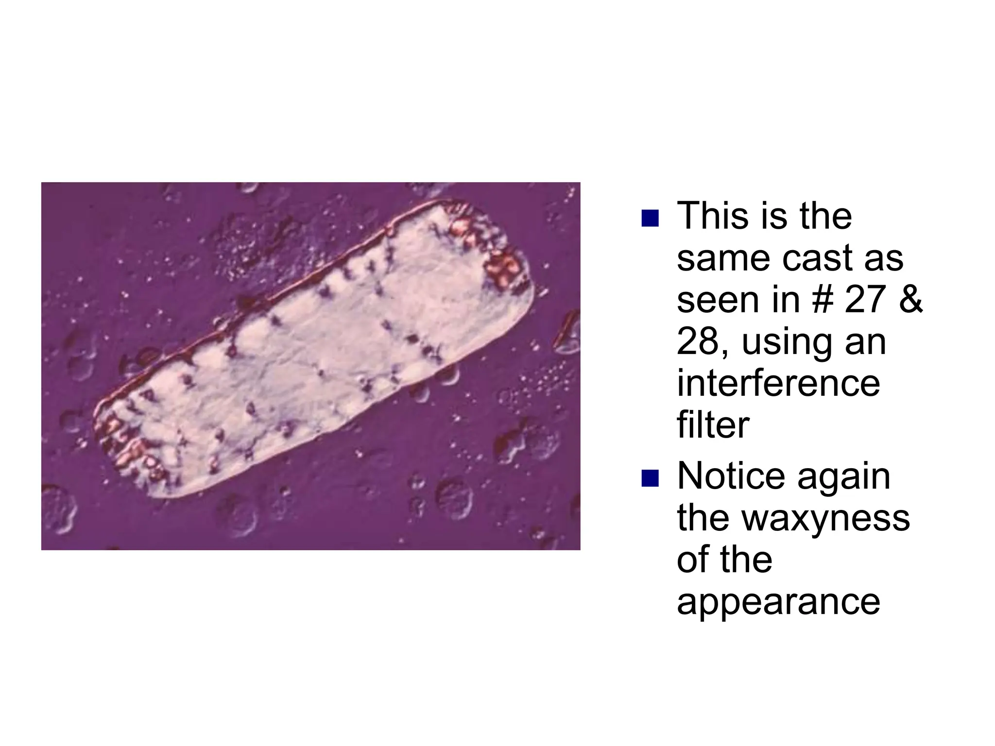  This is the
same cast as
seen in # 27 &
28, using an
interference
filter
 Notice again
the waxyness
of the
appearance
 