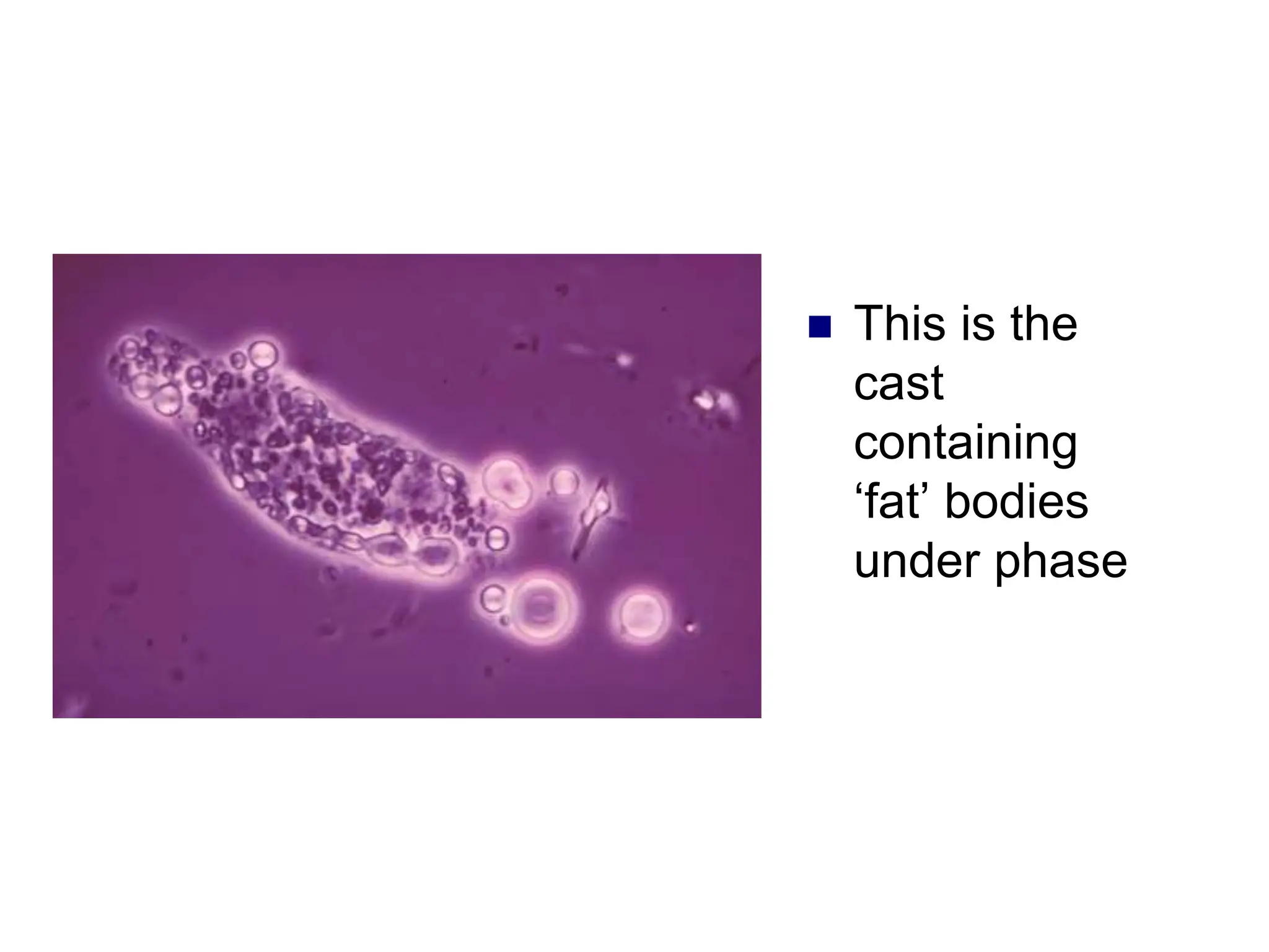  This is the
cast
containing
‘fat’ bodies
under phase
 