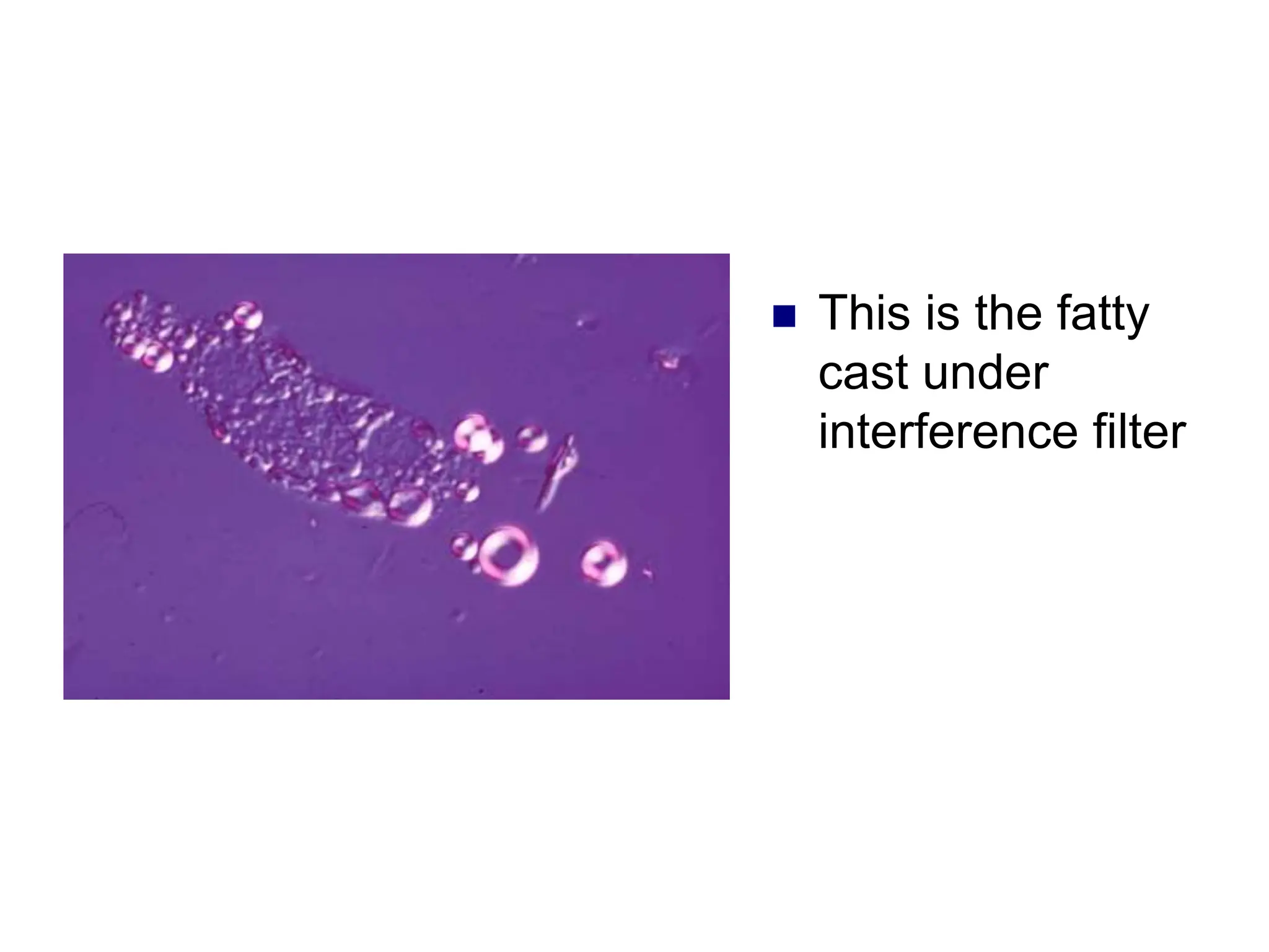  This is the fatty
cast under
interference filter
 