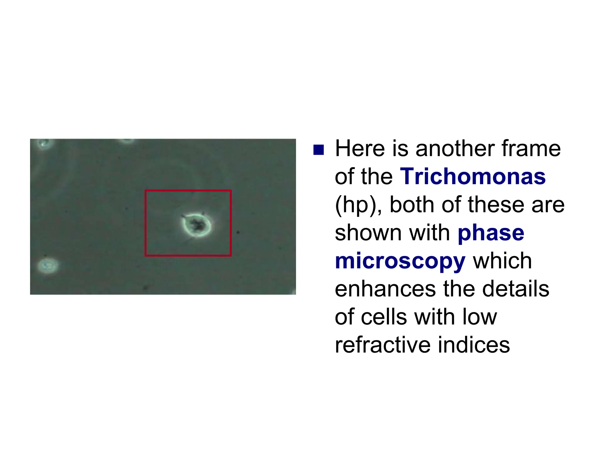  Here is another frame
of the Trichomonas
(hp), both of these are
shown with phase
microscopy which
enhances the details
of cells with low
refractive indices
 