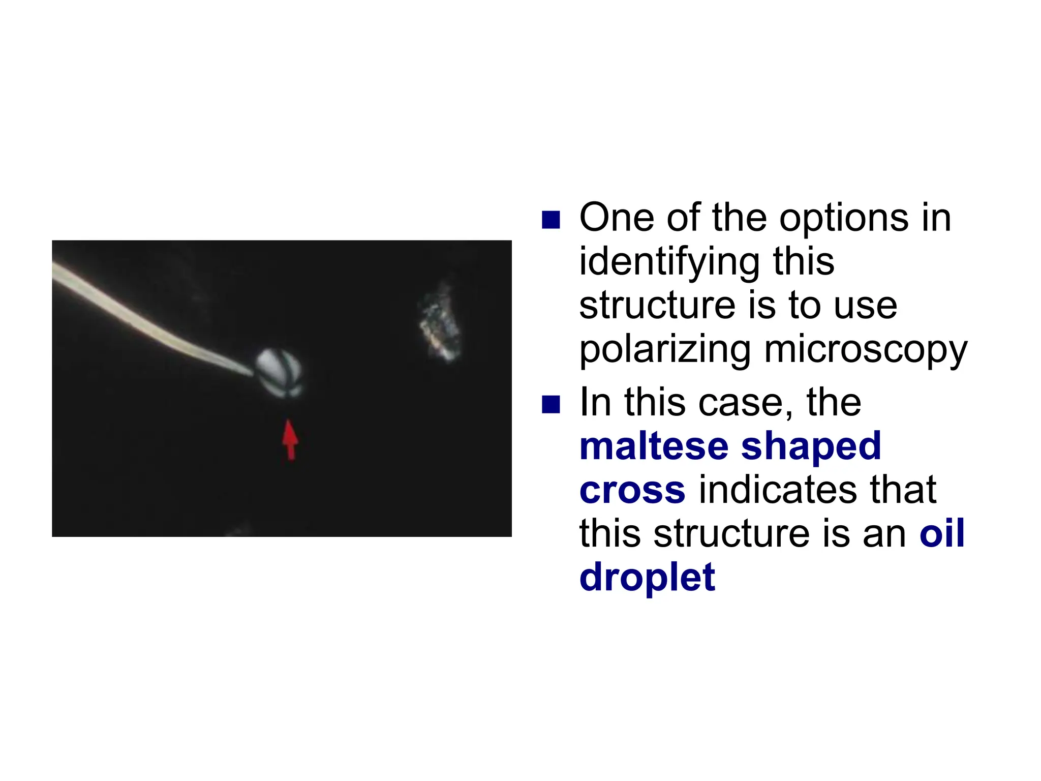  One of the options in
identifying this
structure is to use
polarizing microscopy
 In this case, the
maltese shaped
cross indicates that
this structure is an oil
droplet
 