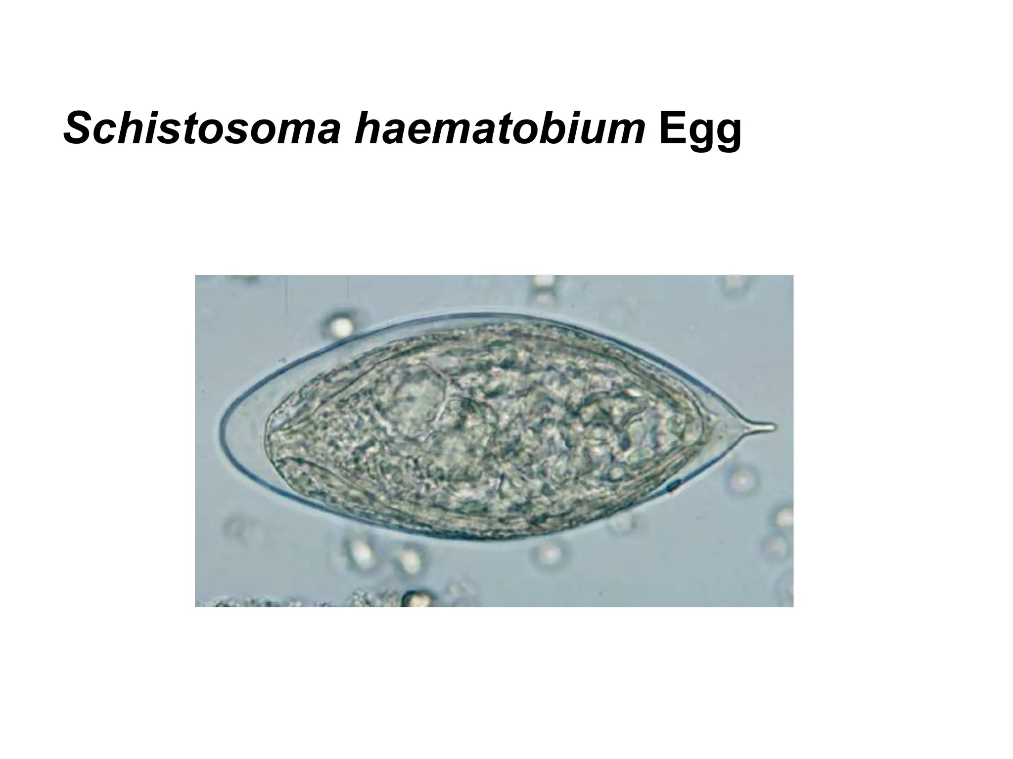 Schistosoma haematobium Egg
 