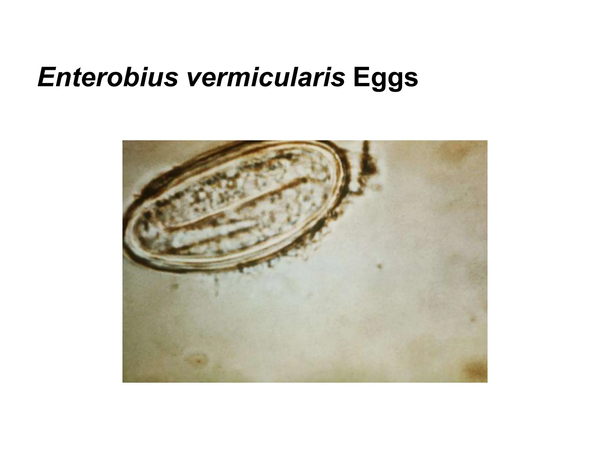 Enterobius vermicularis Eggs
 
