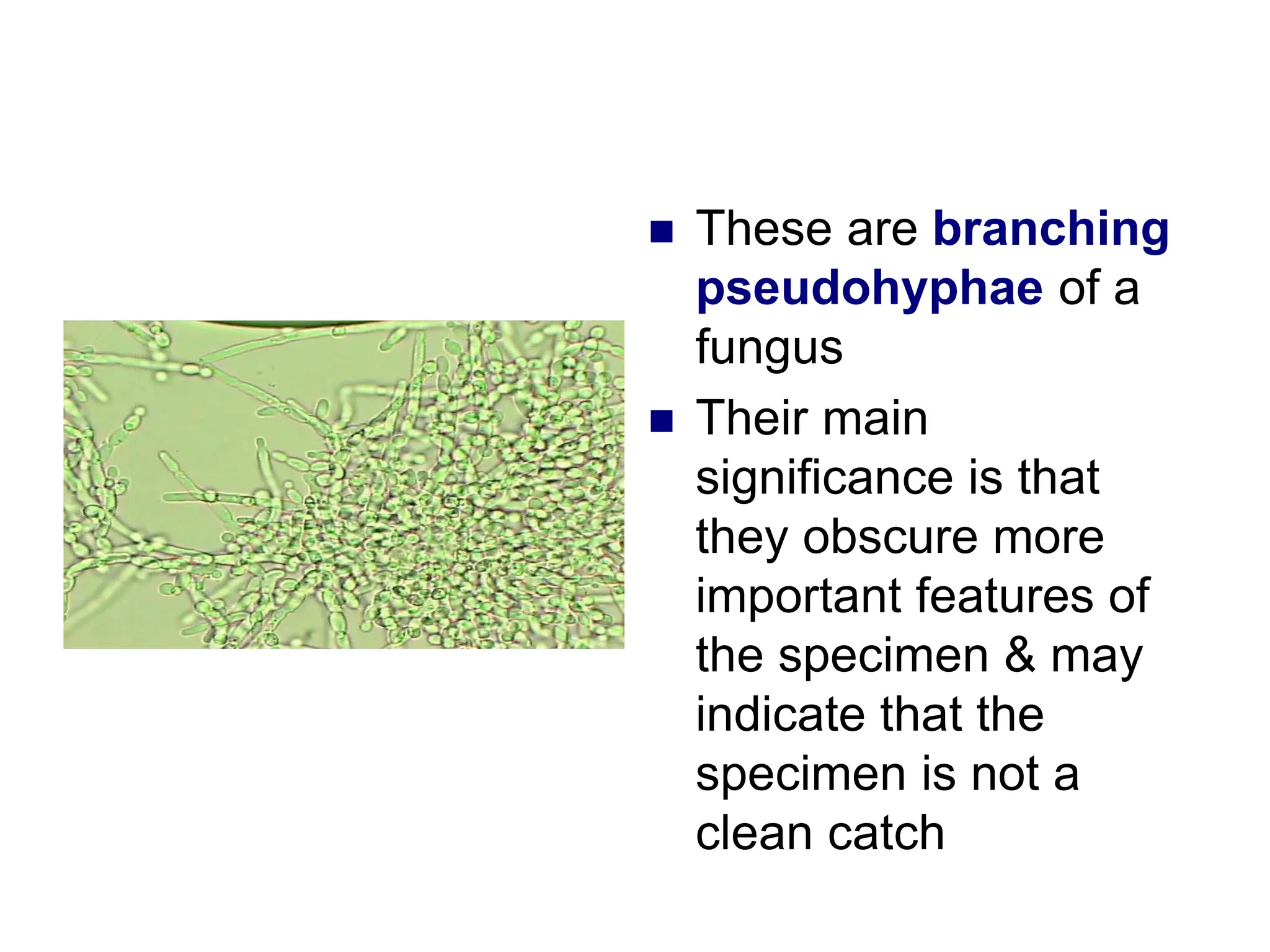  These are branching
pseudohyphae of a
fungus
 Their main
significance is that
they obscure more
important features of
the specimen & may
indicate that the
specimen is not a
clean catch
 