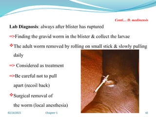 02/24/2025 Chapter 5 41
Conti… D. medinensis
Lab Diagnosis: always after blister has ruptured
=>Finding the gravid worm in the blister & collect the larvae
The adult worm removed by rolling on small stick & slowly pulling
daily
=> Considered as treatment
=>Be careful not to pull
apart (recoil back)
Surgical removal of
the worm (local anesthesia)
 
