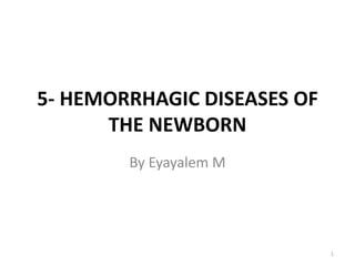 5- HEMORRHAGIC DISEASES OF
THE NEWBORN
By Eyayalem M
1
 