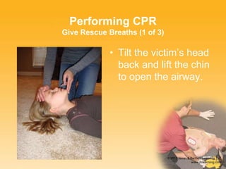 Performing CPR
Give Rescue Breaths (1 of 3)
• Tilt the victim’s head
back and lift the chin
to open the airway.
 