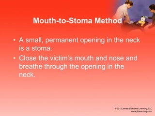 Mouth-to-Stoma Method
• A small, permanent opening in the neck
is a stoma.
• Close the victim’s mouth and nose and
breathe through the opening in the
neck.
 