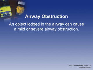 Airway Obstruction
An object lodged in the airway can cause
a mild or severe airway obstruction.
 