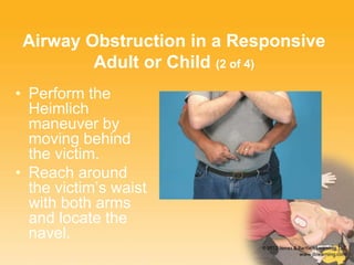 Airway Obstruction in a Responsive
Adult or Child (2 of 4)
• Perform the
Heimlich
maneuver by
moving behind
the victim.
• Reach around
the victim’s waist
with both arms
and locate the
navel.
 
