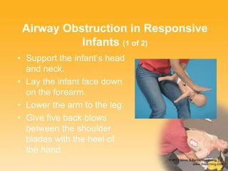 Airway Obstruction in Responsive
Infants (1 of 2)
• Support the infant’s head
and neck.
• Lay the infant face down
on the forearm.
• Lower the arm to the leg.
• Give five back blows
between the shoulder
blades with the heel of
the hand.
 