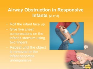 Airway Obstruction in Responsive
Infants (2 of 2)
• Roll the infant face up.
• Give five chest
compressions on the
infant’s sternum using
two fingers.
• Repeat until the object
is removed or the
infant becomes
unresponsive.
 