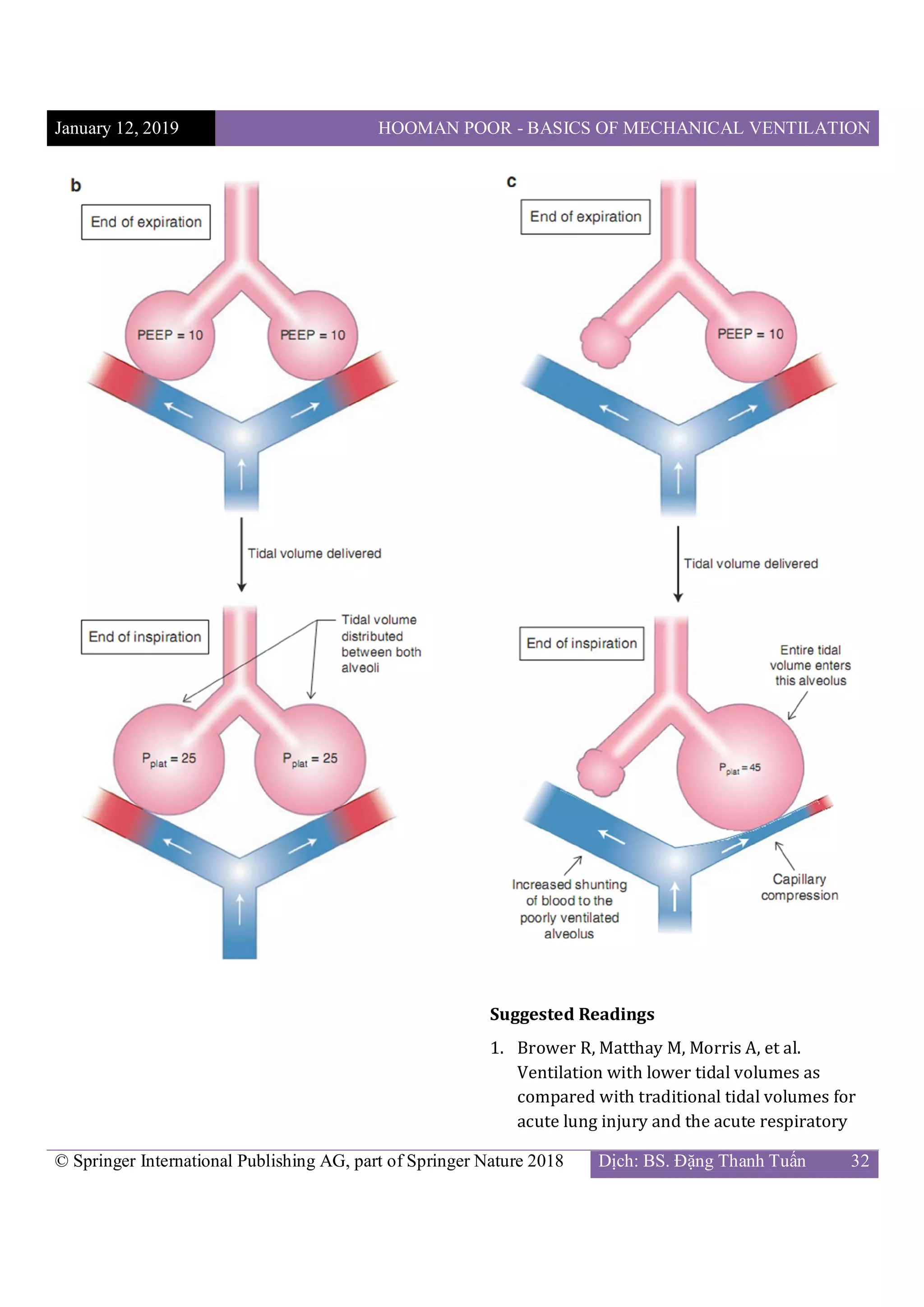 Poor Ventilation Example Chapter 5 hooman poor - basics of mechanical ventilation 2018 | PDF