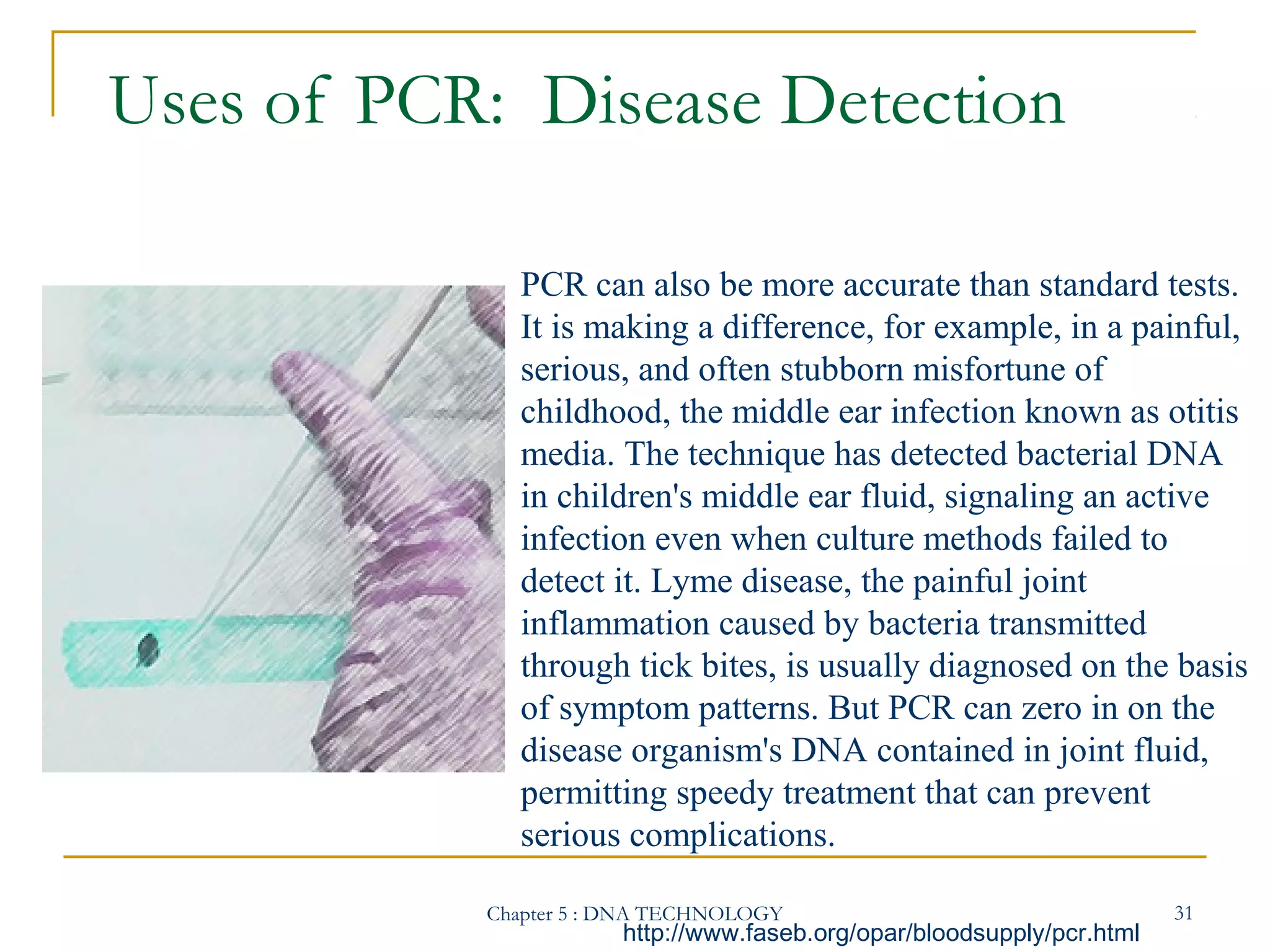 Uses of PCR: Disease Detection
PCR can also be more accurate than standard tests.
It is making a difference, for example, in a painful,
serious, and often stubborn misfortune of
childhood, the middle ear infection known as otitis
media. The technique has detected bacterial DNA
in children's middle ear fluid, signaling an active
infection even when culture methods failed to
detect it. Lyme disease, the painful joint
inflammation caused by bacteria transmitted
through tick bites, is usually diagnosed on the basis
of symptom patterns. But PCR can zero in on the
disease organism's DNA contained in joint fluid,
permitting speedy treatment that can prevent
serious complications.
Chapter 5 : DNA TECHNOLOGY

http://www.faseb.org/opar/bloodsupply/pcr.html

31

 