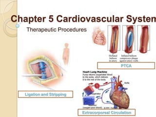 Chapter 5 Cardiovascular System
   Therapeutic Procedures




                                               PTCA




  Ligation and Stripping



                           Extracorporeal Circulation
 
