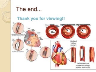 Chapter 5 cardiovascular system | PPTX