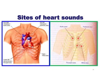 36
Sites of heart sounds
 