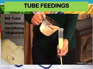 TUBE FEEDINGS
 
