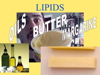 LIPIDS
 