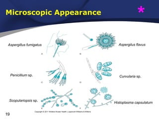 Microscopic Appearance

Aspergillus fumigatus

Penicillium sp.

Aspergilus flavus

Curvularia sp.

Scopulariopsis sp.

19

*

Copyright © 2011 Wolters Kluwer Health | Lippincott Williams & Wilkins

Histoplasma capsulatum

 