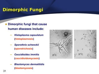 Dimorphic Fungi
• Dimorphic fungi that cause
human diseases include:

–

Histoplasma capsulatum
(histoplasmosis)

–

Sporothrix schenckii
(sporotrichosis)

–

Coccidioides immitis
(coccidioidomycosis)

–

Blastomyces dermatitidis
(blastomycosis)

31

 