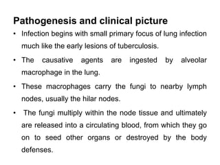 Pathogenesis and clinical picture
• Infection begins with small primary focus of lung infection
much like the early lesion...