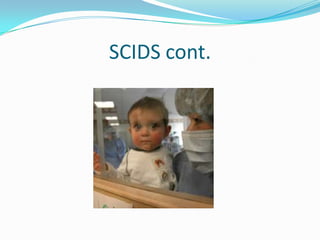SCIDS cont.