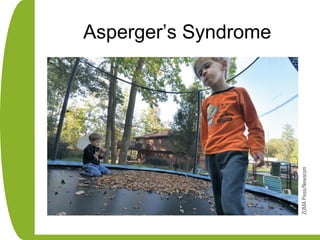 Asperger’s Syndrome
 