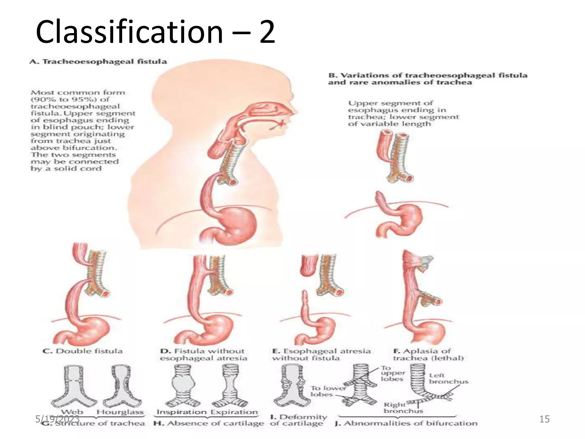 Classification – 2
5/19/2023 15
 
