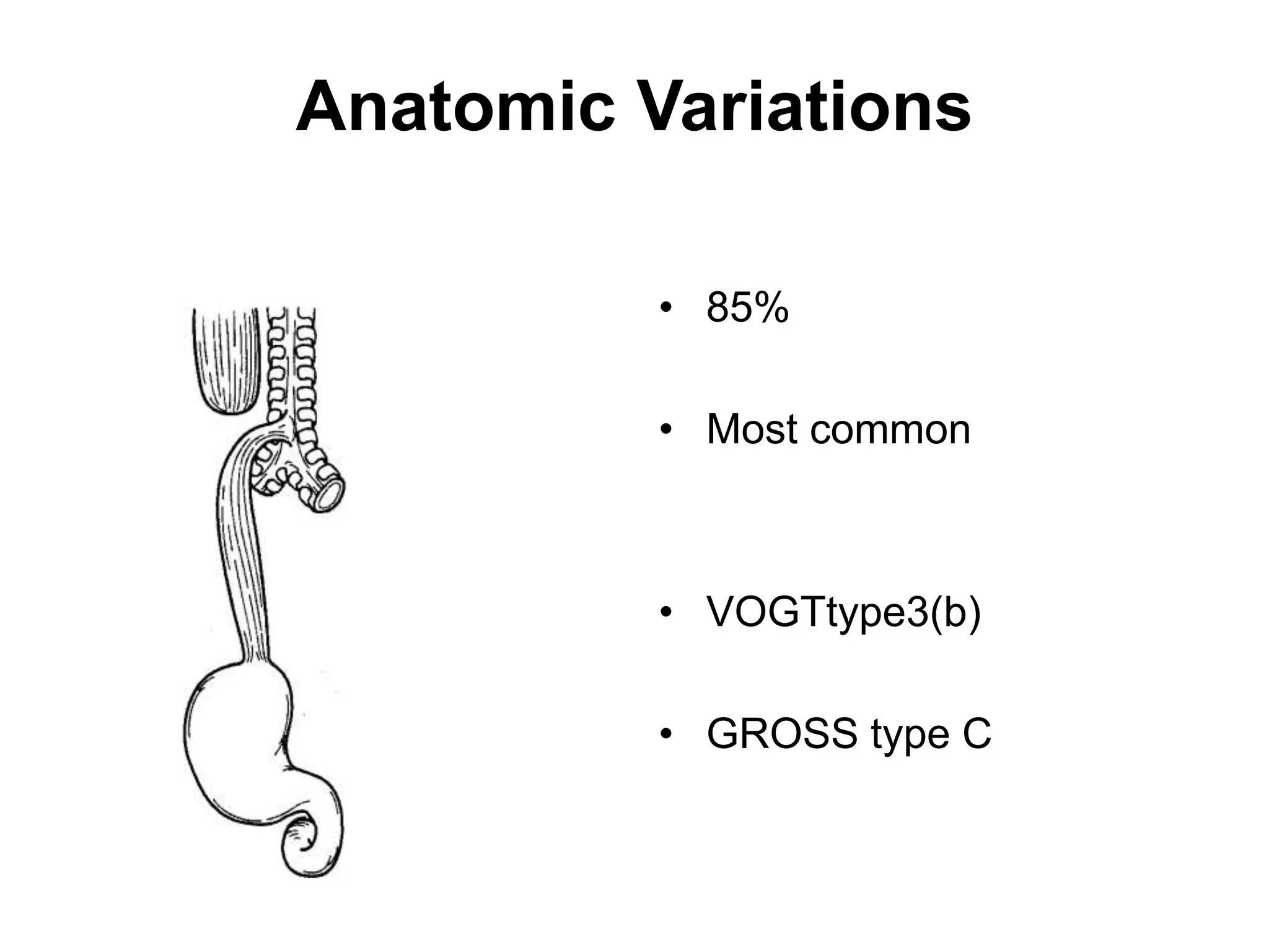 Anatomic Variations
• 85%
• Most common
• VOGTtype3(b)
• GROSS type C
 